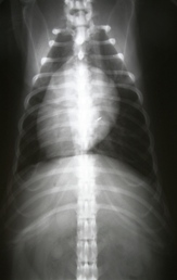 x-ray